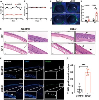 Involvement of endoplasmic reticulum stress in trigeminal ganglion corneal neuron injury in dry eye disease